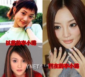 李小璐