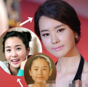 李多海被曝整容